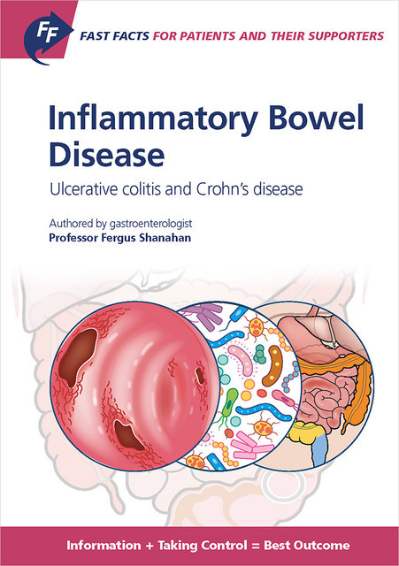Fast Facts: Inflammatory Bowel Disease for Patients and their Supporters, F. Shanahan