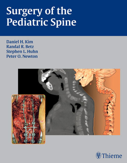 Surgery of the Pediatric Spine, Daniel H.Kim, Peter O.Newton, Randal R.Betz, Stephen L.Huhn