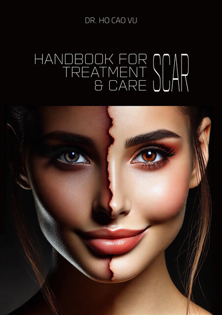 HANDBOOK FOR SCAR TREATMENT & CARE, Cao Vu Ho