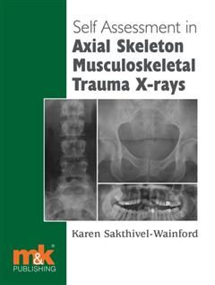 Self-assessment in Axial Musculoskeletal Trauma X-rays, Karen Sakthivel-Wainford