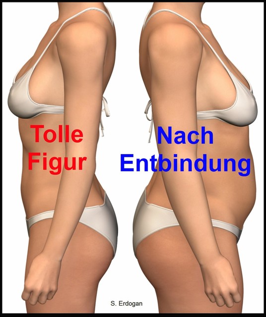 Tolle Figur – Nach Entbindung, S. Erdogan