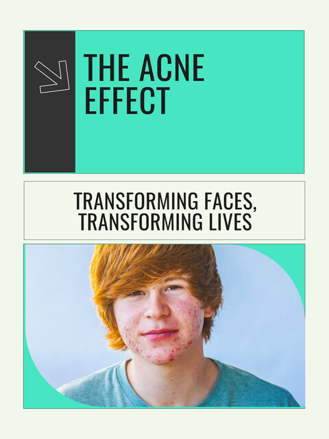 The Acne Effect, Scarlett Y. Turner