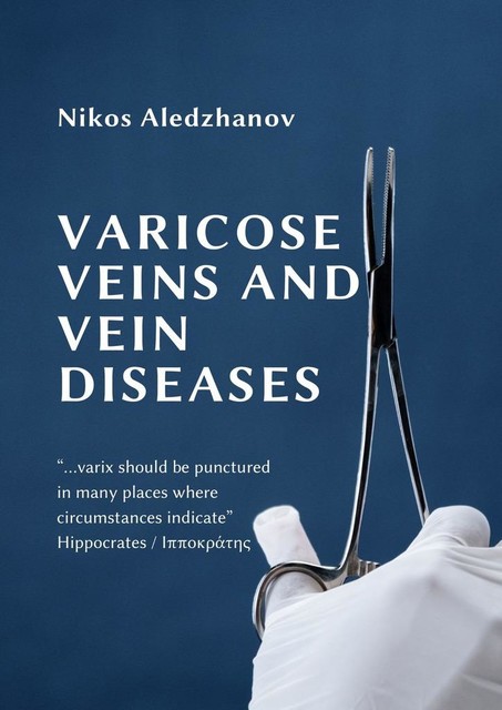VARICOSE VEINS AND VEIN DISEASES, Nikos Aledzhanov