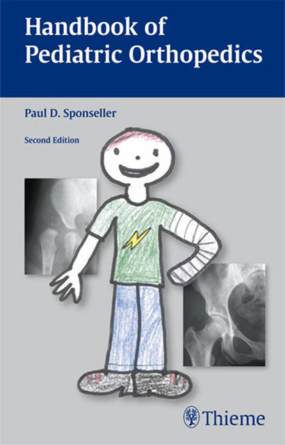 Handbook of Pediatric Orthopedics, Paul D.Sponseller
