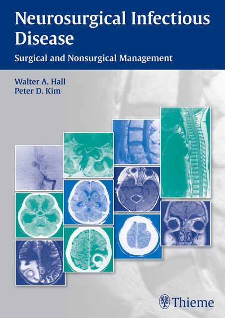Neurosurgical Infectious Disease, Walter A.Hall, Peter Kim