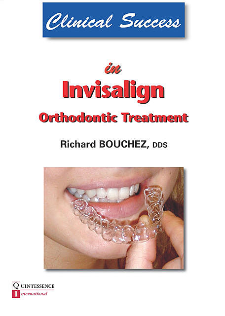 Clinical Success in Invisalign Orthodontic Treatment, Richard Bouchez