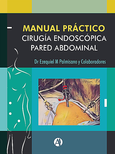 Manual Práctico de Cirugía Endoscópica de la Pared Abdominal, Ezequiel Mariano Palmisano