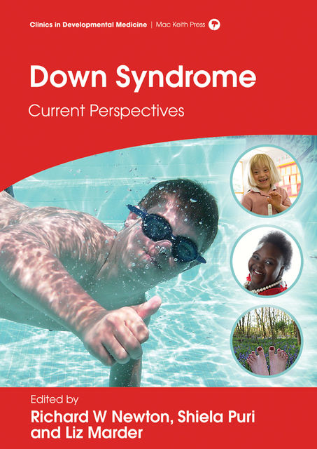 Down Syndrome, Richard Newton, Liz Marder, Shiela C Puri