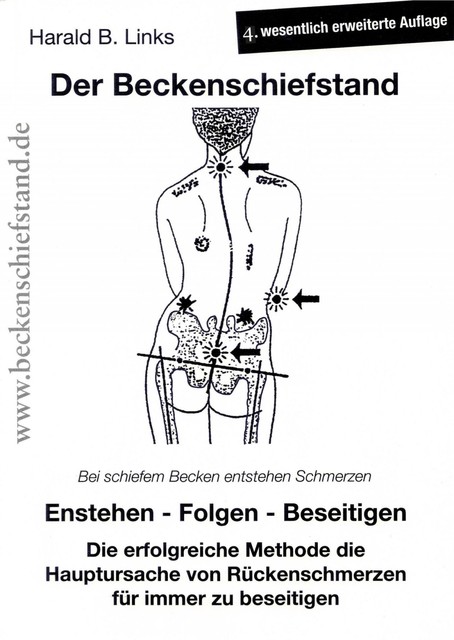 Der Beckenschiefstand, Harald Links