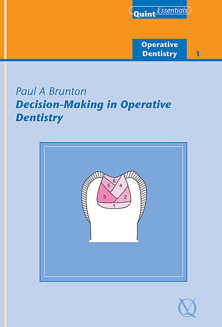 Decision-Making in Operative Dentistry, Brunton Paul