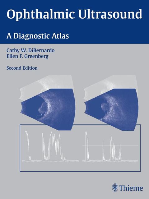 Ophthalmic Ultrasound, Cathy W.DiBernardo, Ellen F.Greenberg