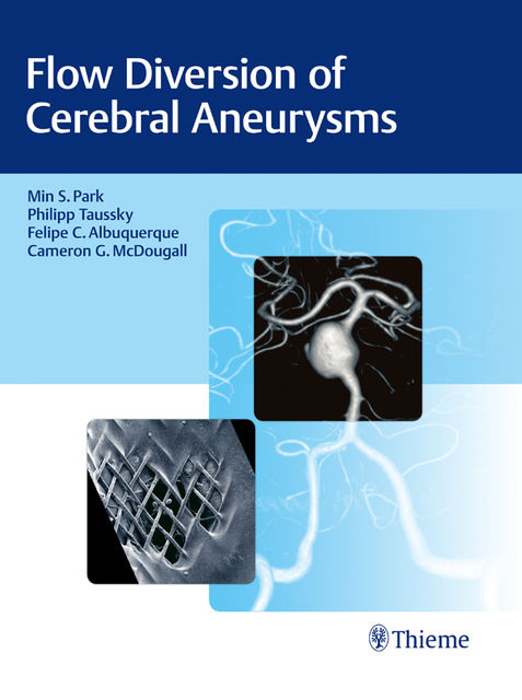Flow Diversion of Cerebral Aneurysms, Felipe C.Albuquerque, Min S. Park, Philipp Taussky