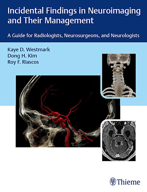 Incidental Findings in Neuroimaging and Their Management, Roy Riascos, Dong H. Kim, Kaye D. Westmark
