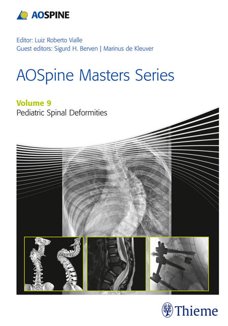 AOSpine Masters Series, Volume 9: Pediatric Spinal Deformities, Luiz Roberto Vialle