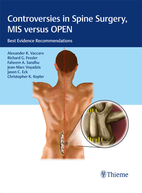 Controversies in Spine Surgery, MIS versus OPEN, Alexander R.Vaccaro, Richard G.Fessler, Faheem A.Sandhu, Jason C.Eck, Christopher K. Kepler, JeanMarc Voyadzis