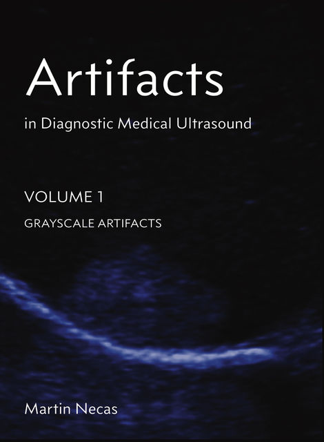 Artifacts in Diagnostic Medical Ultrasound, Martin Necas