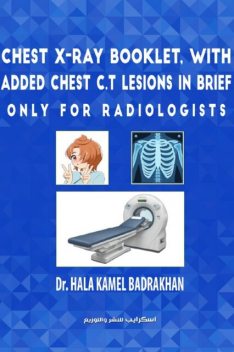 Chest X-Ray Booklet, with added Chest C.T Lesions in brief Only for Radiologists, Halla kamel Badrakhan