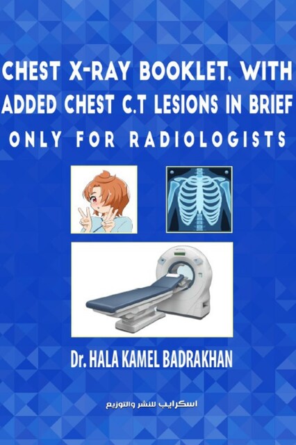 Chest X-Ray Booklet, with added Chest C.T Lesions in brief Only for Radiologists, Halla kamel Badrakhan
