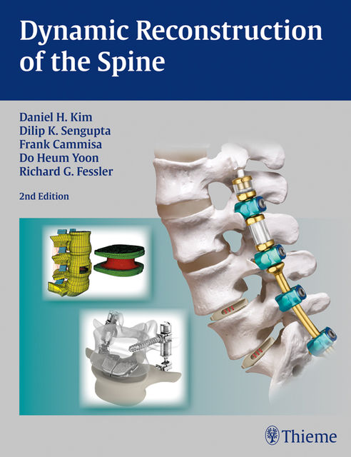 Dynamic Reconstruction of the Spine, Daniel H.Kim, Richard G.Fessler, Dilip K.Sengupta, Do Heum Yoon, Frank P.Cammisa