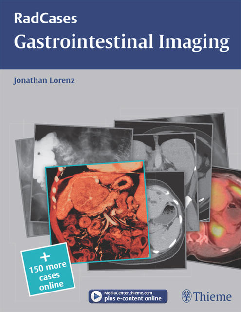 Gastrointestinal Imaging, Jonathan Lorenz