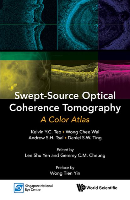 Swept-Source Optical Coherence Tomography, AndrewS.H.Tsai, Chee Wai Wong, DanielS.W.Ting, KelvinY.C.Teo