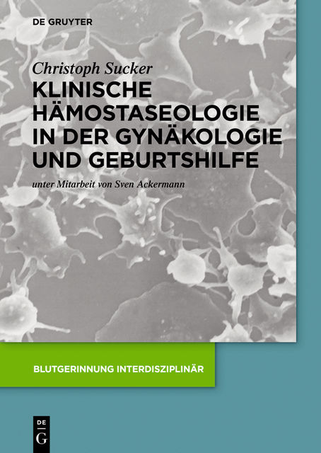 Klinische Hämostaseologie in der Gynäkologie und Geburtshilfe, Christoph Sucker