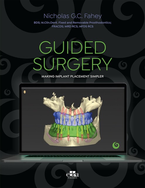 Guided surgery, Nicholas G.C. Fahey