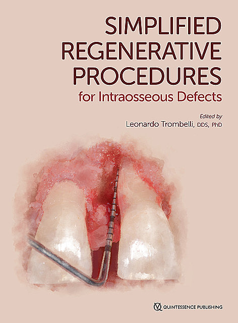 Simplified Regenerative Procedures for Intraosseous Defects, Leonardo Trombelli