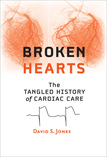 Broken Hearts, David Jones