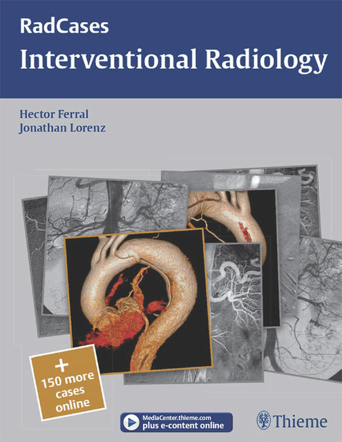 Interventional Radiology, Hector Ferral, Jonathan Lorenz