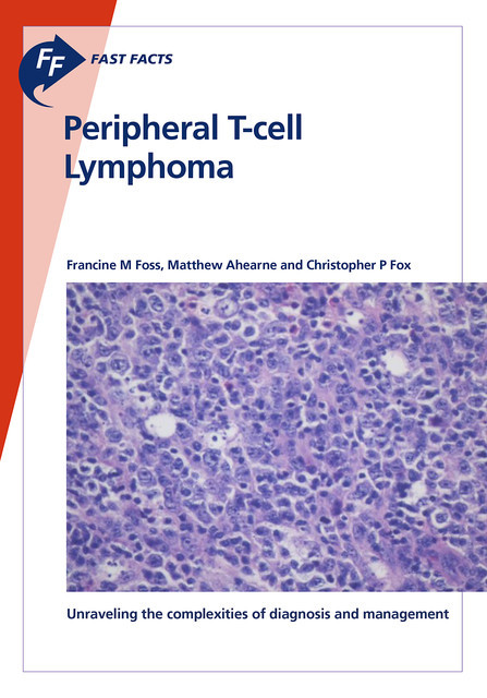 Fast Facts: Peripheral T-cell Lymphoma, C.P. Fox, F. Foss, M. Ahearne