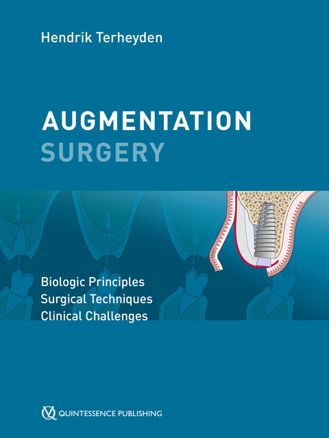 Augmentation Surgery, Hendrik Terheyden