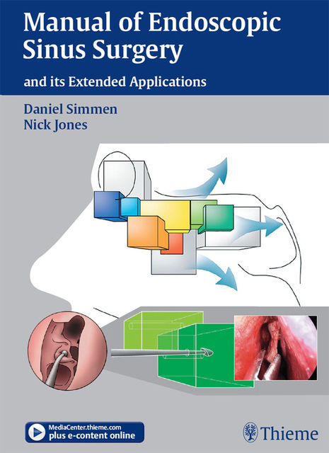 Manual of Endoscopic Sinus Surgery, Daniel Simmen, Nick Jones