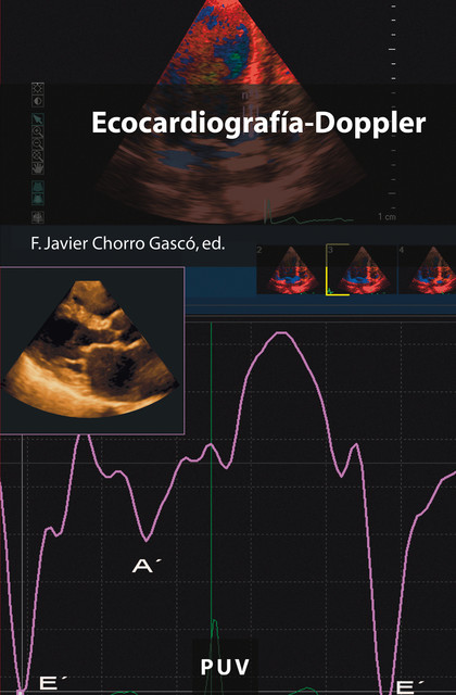 Ecocardiografía-Doppler, Varios Autores
