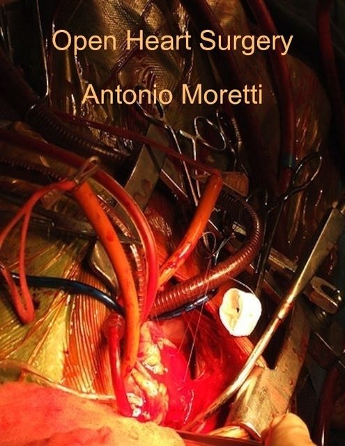 Open Heart Surgery, Antonio Moretti