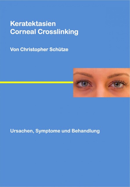 Keratektasien, Christopher Schütze