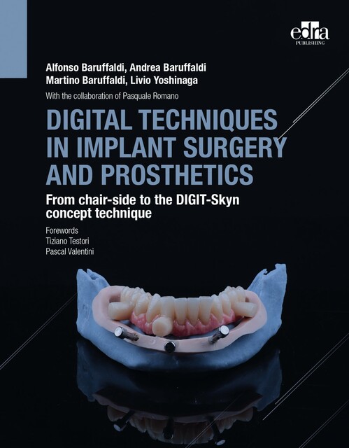 Digital Techniques in Implant Surgery and Prosthetics, Alfonso Baruffaldi, Andrea Baruffaldi, Livio Yoshinaga, Martino Baruffaldi