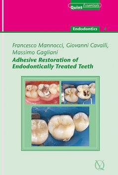 Adhesive Restoration of Endodontically Treated Teeth, Francesco Mannocci, Giovanni Cavalli, Massimo Gagliani