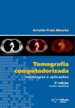 Tomografia computadorizada, Arnaldo Prata Mourão
