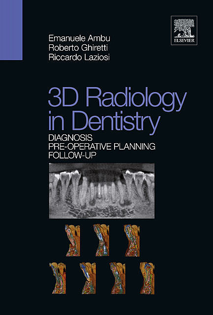 3D Radiology in Dentistry, Emanuele Ambu, Riccardo Laziosi, Roberto Ghiretti
