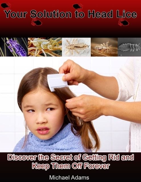 Your Solution to Head Lice: Discover the Secret of Getting Rid and Keep Them Off Forever, Michael Adams
