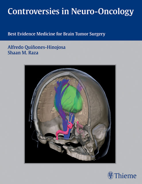 Controversies in Neuro-Oncology, Alfredo Quiñones-Hinojosa, Shaan M.Raza