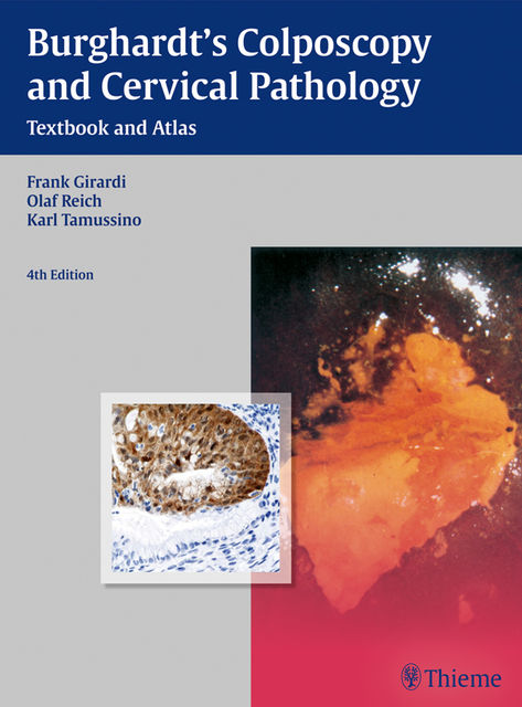 Burghardt's Colposcopy and Cervical Pathology, Frank Girardi, Karl Tamussino, Olaf Reich