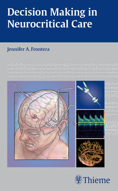 Decision Making in Neurocritical Care, Jennifer A.Frontera