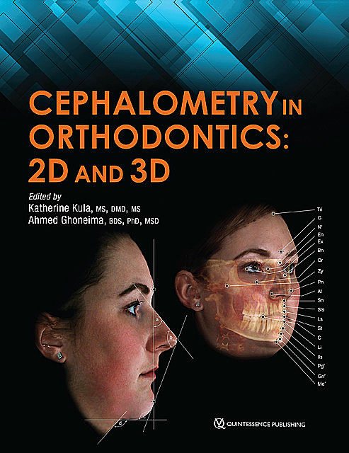 Cephalometry in Orthodontics, Ahmed Ghoneima, Katherine Kula