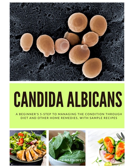 Candida Albicans, Patrick Marshwell