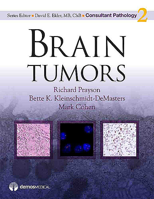 Brain Tumors, David Elder, Mark R. Cohen, Bette K. Kleinschmidt-DeMasters, ChB, MB, Richard Prayson