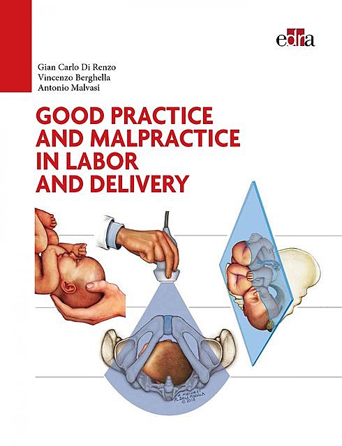 Good practice and malpractice in labor and delivery, Antonio Malvasi, Gian Carlo Di Renzo, Vincenzo Berghella