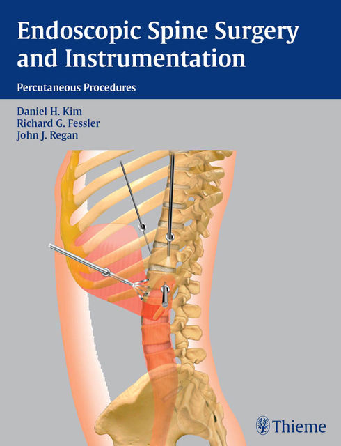 Endoscopic Spine Surgery and Instrumentation, John Regan, Daniel H.Kim, Richard G.Fessler