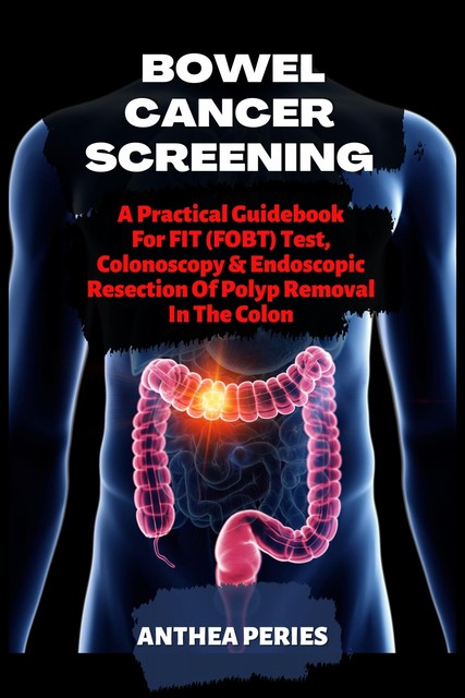 Bowel Cancer Screening, Anthea Peries